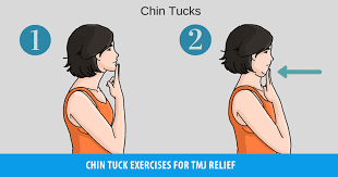 Chin tuck